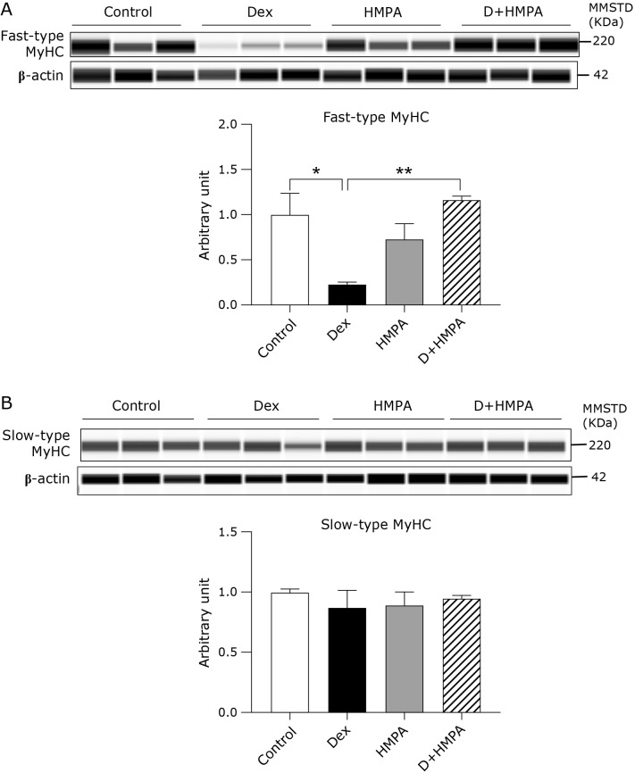 3-(4-Hydroxy-3-methoxyphenyl) propionic acid mitigates dexamethasone-induced muscle atrophy by attenuating Atrogin-1 and MuRF-1 expression in mouse C2C12 skeletal myotubes.
