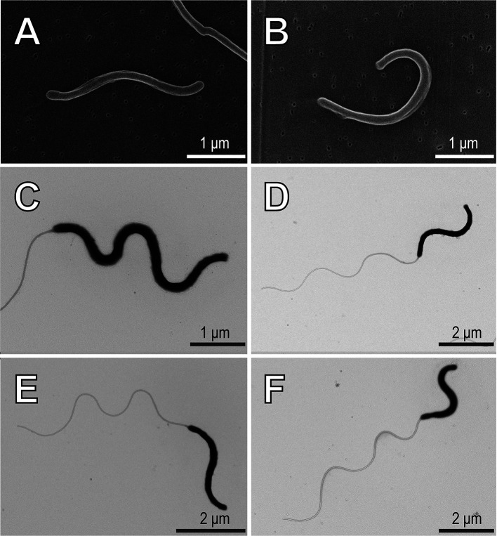 Characterization of a Marine Bacterium Passing through a 0.1-μm Pore-sized Filter.