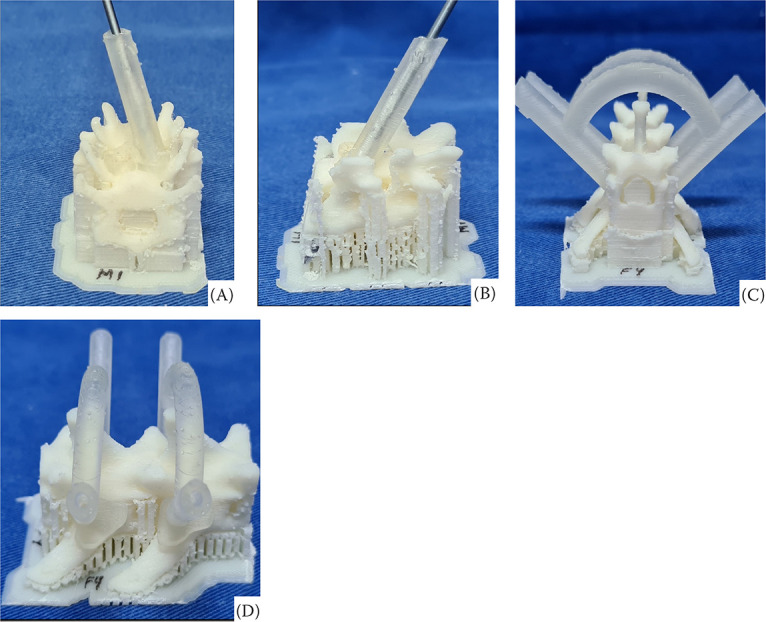Assessment of the accuracy of patient-specific drilling guides for cervical (C5-C6) and lumbar (L4-L5) vertebrae in cats.
