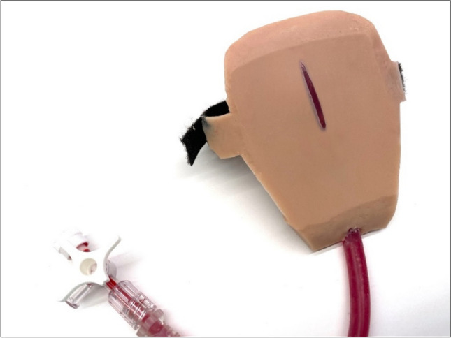 High-Fidelity Clinical Simulation to Improve a Pediatric Clinical Trial Design: Lessons Learned and Conceptualization of the Return on Investment (ROI) and Return on Engagement (ROE) Analysis.