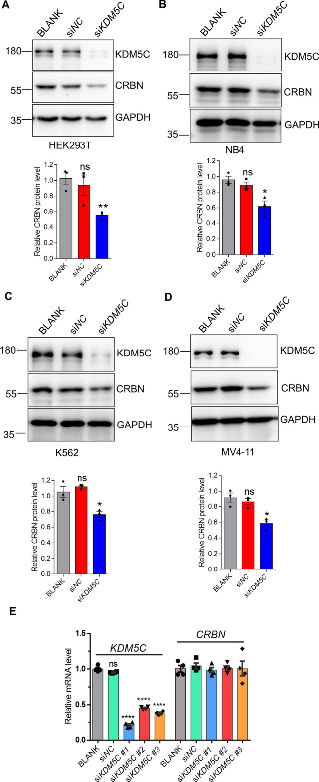 The histone demethylase KDM5C enhances the sensitivity of acute myeloid leukemia cells to lenalidomide by stabilizing cereblon.