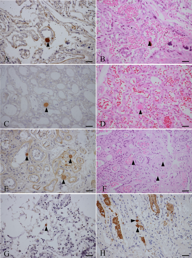 Isolation of Toxoplasma gondii from the placenta of northern fur seals (Callorhinus ursinus) and potential transplacental transmission of the parasite.