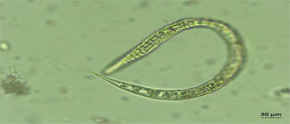 Epidemiology of Helminthic Infections and Phylogenetic Tree of <i>Strongyloides stercoralis</i> in Rubber Tree Plantation in Lower Northern Part of Thailand.