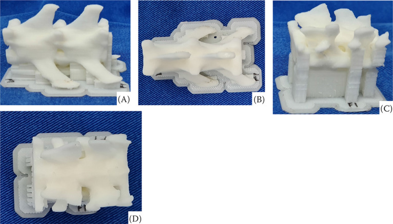 Assessment of the accuracy of patient-specific drilling guides for cervical (C5-C6) and lumbar (L4-L5) vertebrae in cats.