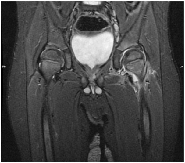 Diagnosis and management of septic arthritis: A current concepts review.