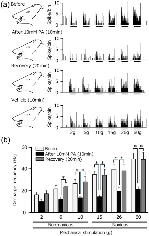 Gut microbiota-derived short-chain fatty acid suppresses the excitability of rat nociceptive secondary neurons via G-protein-coupled receptor 41 signaling.