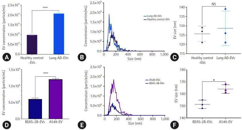 Extracellular vesicle-associated epidermal growth factor receptor as a potential liquid biopsy biomarker in lung adenocarcinoma: a case-control study.