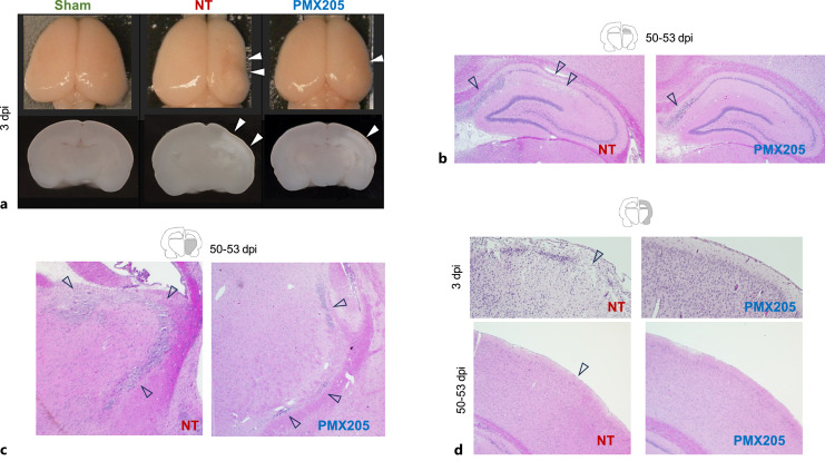 Structural and Functional Effects of C5aR1 Antagonism in a Rat Model of Neonatal Hypoxic-Ischemic Encephalopathy.
