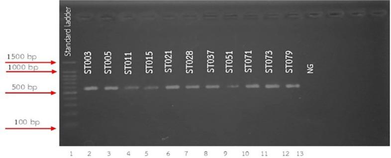 Epidemiology of Helminthic Infections and Phylogenetic Tree of <i>Strongyloides stercoralis</i> in Rubber Tree Plantation in Lower Northern Part of Thailand.
