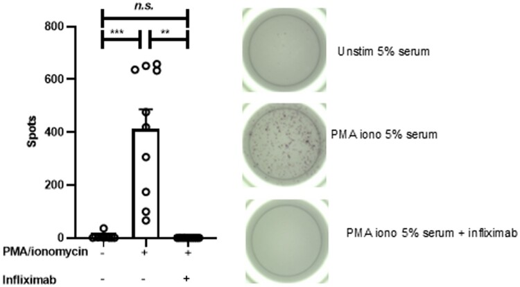 Combining magnetically isolated CD45 cells with serum maintains intact drug responsiveness for ELISpot analysis in clinical trials.