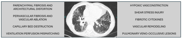 Therapeutic options for patients with pulmonary hypertension and interstitial lung disease.