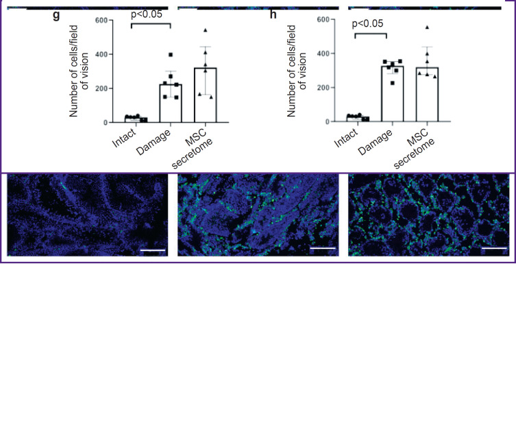 The Role of Macrophages in Implementing the Effects of Secretome of Mesenchymal Stromal Cells in the Spermatogonial Stem Cell Niche.