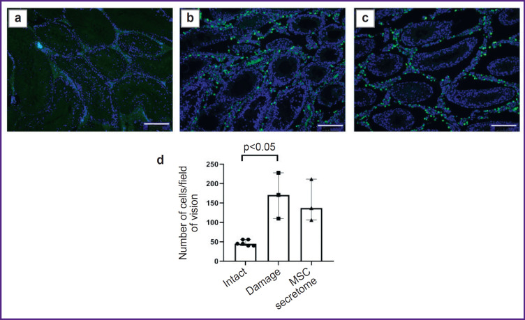 The Role of Macrophages in Implementing the Effects of Secretome of Mesenchymal Stromal Cells in the Spermatogonial Stem Cell Niche.