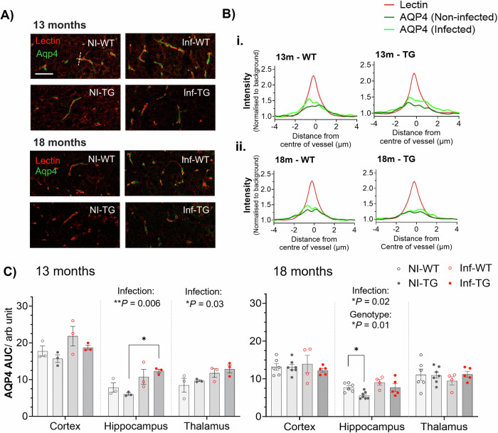 MRI detects blood-brain barrier alterations in a rat model of Alzheimer's disease and lung infection.