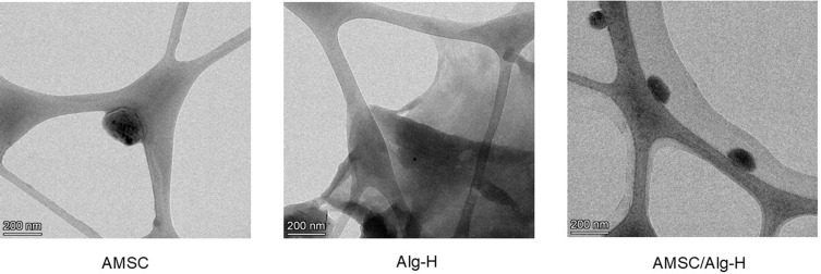 Alginate-Based Hydrogels with Amniotic Membrane Stem Cells for Wound Dressing Application.