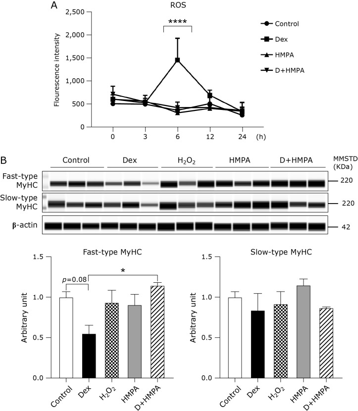 3-(4-Hydroxy-3-methoxyphenyl) propionic acid mitigates dexamethasone-induced muscle atrophy by attenuating Atrogin-1 and MuRF-1 expression in mouse C2C12 skeletal myotubes.