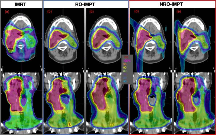 Quantification of beam size impact on intensity-modulated proton therapy with robust optimization in head and neck cancer-comparison with intensity-modulated radiation therapy.