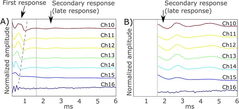 Case report: Potential physiological sources of the late response in epidural spinal recordings induced by spinal cord stimulation during intraoperative neuromonitoring