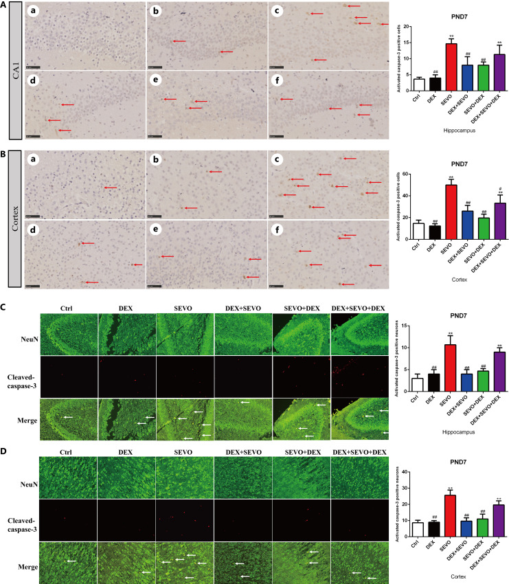 Dexmedetomidine Alleviates the Long-Term Neurodevelopmental Toxicity Induced by Sevoflurane in the Developing Brain.