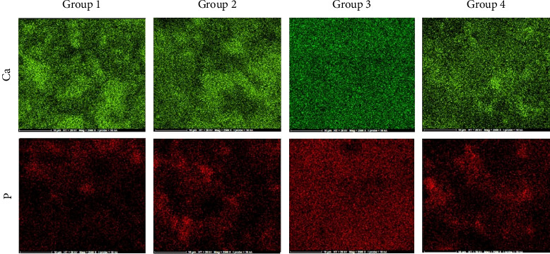 Effect of Manipulation Methods and Storage Environments on the Microstructural, Chemical, and Mechanical Properties of Calcium-Enriched Mixture Cement.