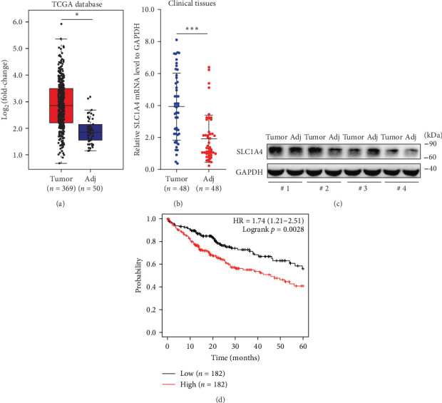 SLC1A4 Promotes Malignant Transformation of Hepatocellular Carcinoma by Activating the AKT Signaling.