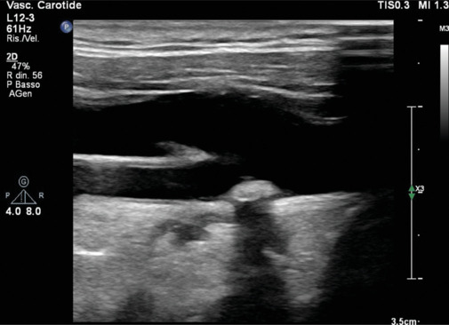 The Role of Imaging in Cardiovascular Prevention: A Comprehensive Review.