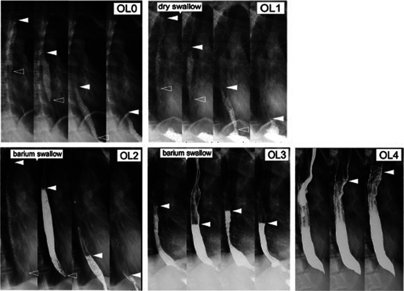 A review of recent developments in the imaging of disorders of gut-brain interaction.