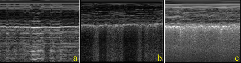 Inter-rater agreement and characterization of pleural line and subpleural fields in canine lung ultrasound: a comparative pilot study between high-frequency linear and curvilinear transducers using B- and M-mode ultrasonographic profiles.