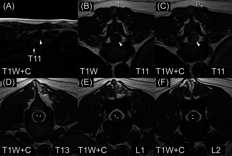 MRI findings in six dogs with ependymoma of the brain and spinal cord.