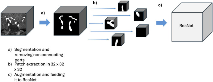 Patch-Wise Deep Learning Method for Intracranial Stenosis and Aneurysm Detection-the Tromsø Study.