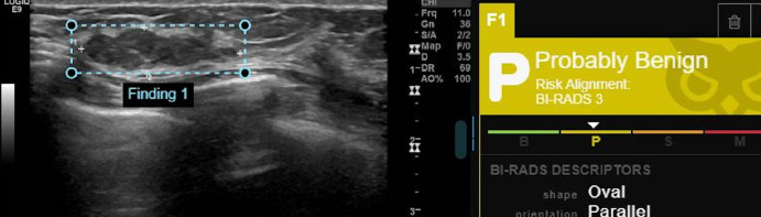 Artificial Intelligence in Diagnostic Breast Ultrasound: A Comparative Analysis of Decision Support Among Radiologists With Various Levels of Expertise.