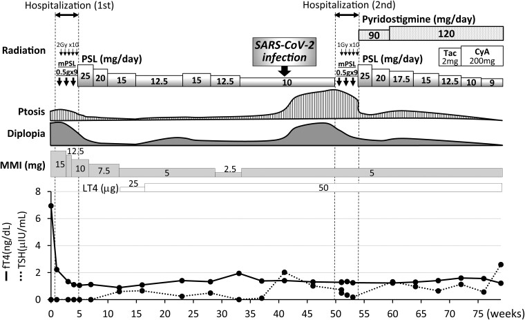 Concomitant Exacerbation of Graves Orbitopathy and Double-Seronegative Myasthenia Gravis after SARS-CoV-2 Infection.