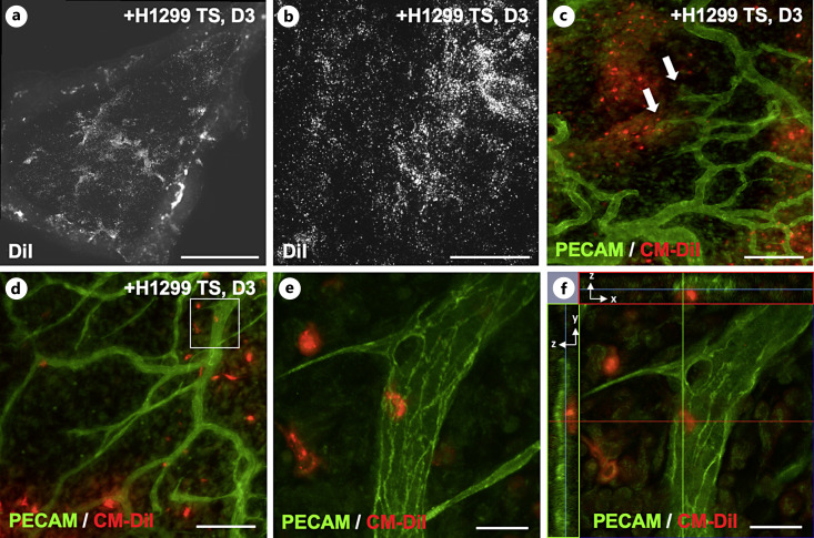 A Novel in vivo Rat Mesentery Model for Studying Tumor Spheroid-Induced Microvascular Remodeling.