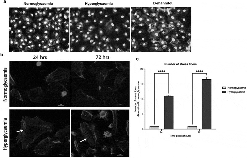 Hyperglycaemia perturbs blood-brain barrier integrity through its effects on endothelial cell characteristics and function.