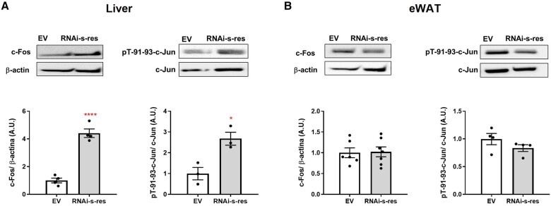 Central Downregulation of S-Resistin Alleviates Inflammation in EWAT and Liver and Prevents Adipocyte Hypertrophy.