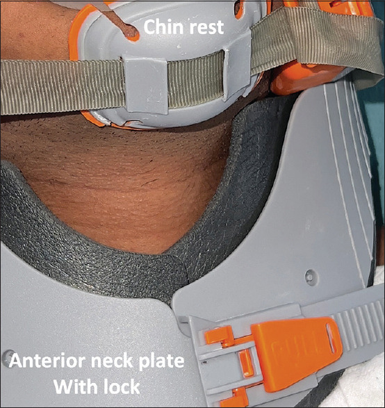 Applicability of Lubo™ collar in non-invasive airway management - A narrative review.