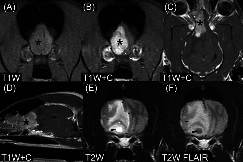 MRI findings in six dogs with ependymoma of the brain and spinal cord.
