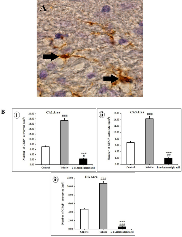 L-α-aminoadipic Acid-induced Astrocytes Inhibition in the Hippocampal CA1 Region, Anxiety-like Behavior, and Memory Impairment.