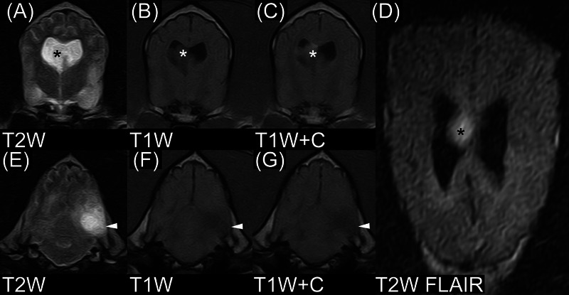 MRI findings in six dogs with ependymoma of the brain and spinal cord.