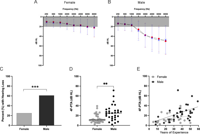 Impacts of hazardous noise levels on hearing loss and tinnitus in dental professionals.
