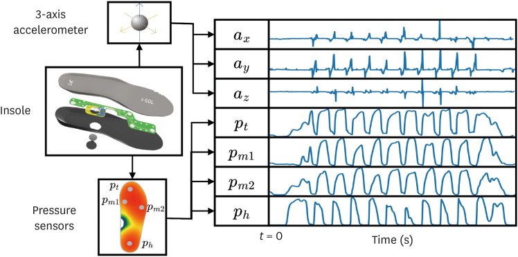 Serial Assessment of Gait Changes After Interventions Using Smart Insole in a Patient With iNPH: A Proof-of-Concept Case Report.