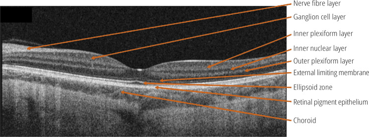 Optical coherence tomography: an introduction.