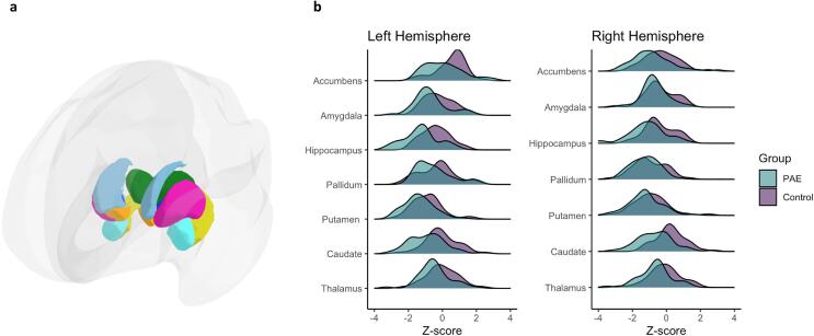 Normative modeling of brain MRI data identifies small subcortical volumes and associations with cognitive function in youth with fetal alcohol spectrum disorder (FASD)