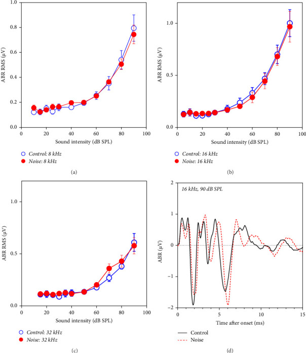Long-Term Moderate-Level Noise Exposure Caused Hyperexcitability in the Central Auditory System.