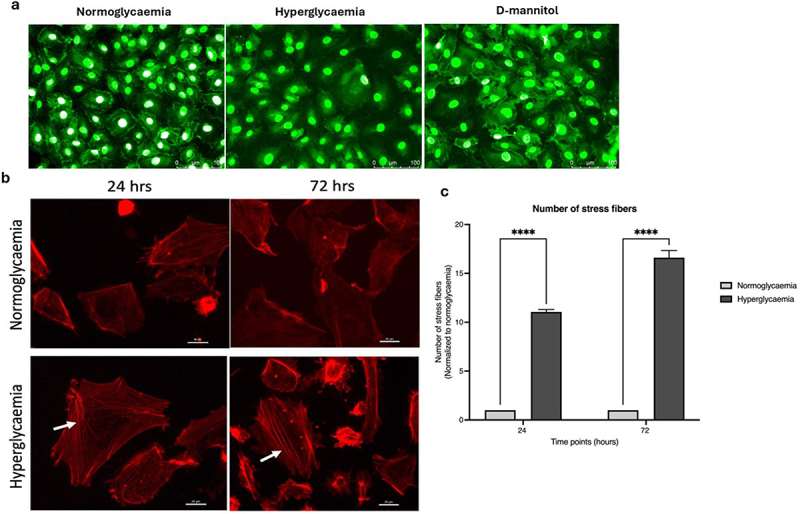 Hyperglycaemia perturbs blood-brain barrier integrity through its effects on endothelial cell characteristics and function.
