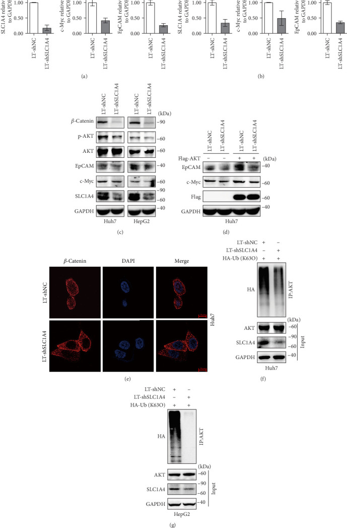 SLC1A4 Promotes Malignant Transformation of Hepatocellular Carcinoma by Activating the AKT Signaling.