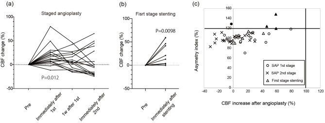 Stepwise Improvement of Cerebral Hemodynamics in Staged Angioplasty for Carotid Artery Stenosis.
