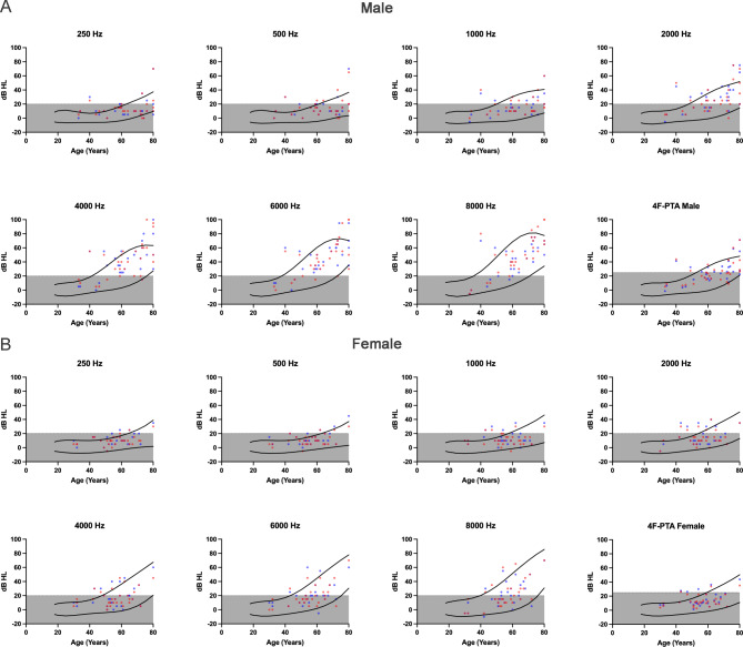 Impacts of hazardous noise levels on hearing loss and tinnitus in dental professionals.