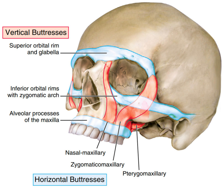 A Shift in Conceptual Thinking of Panfacial Fracture Sequencing: The Major Fragment Theory.