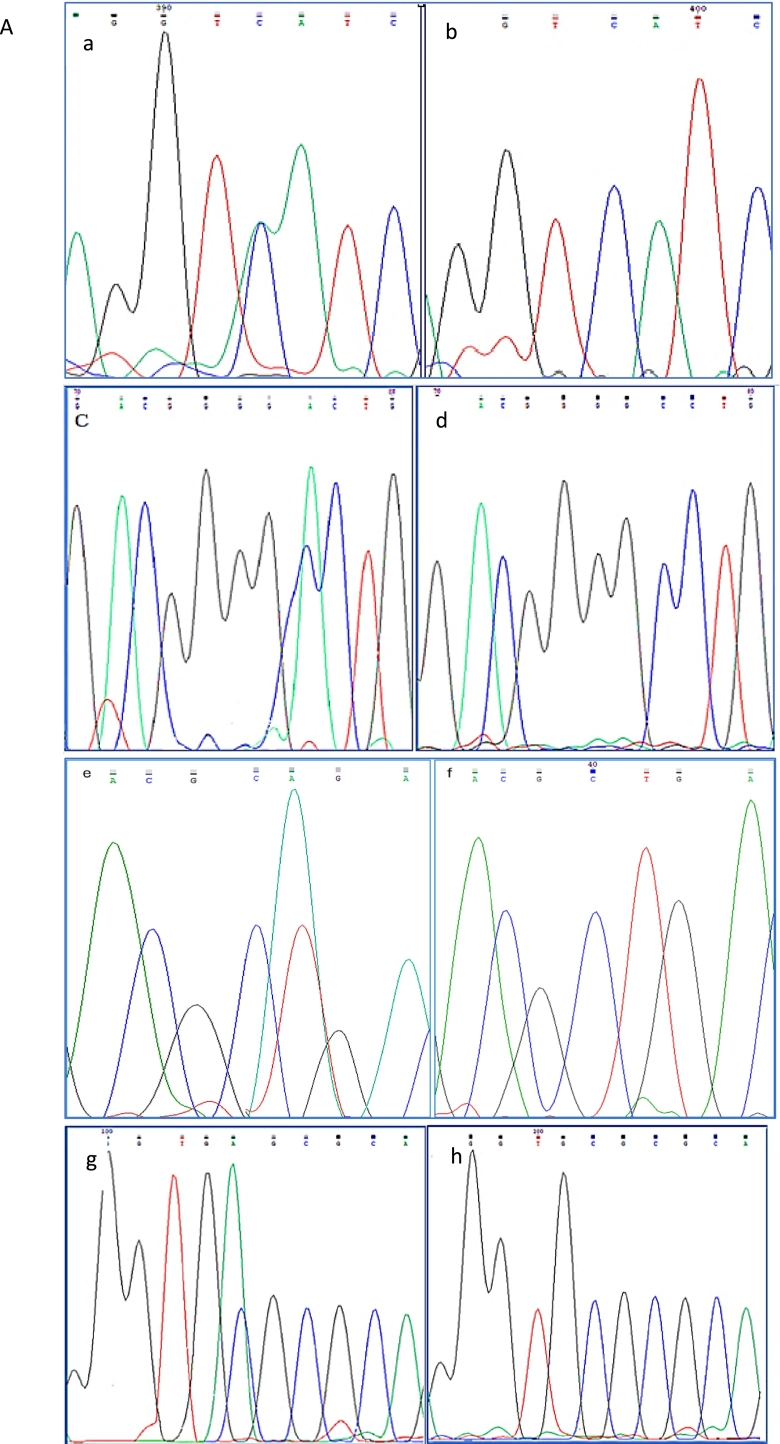 Mucopolysaccharidoses types I and IIIA: Diagnosis and identification of novel polymorphisms associated with common mutations in Moroccan patients